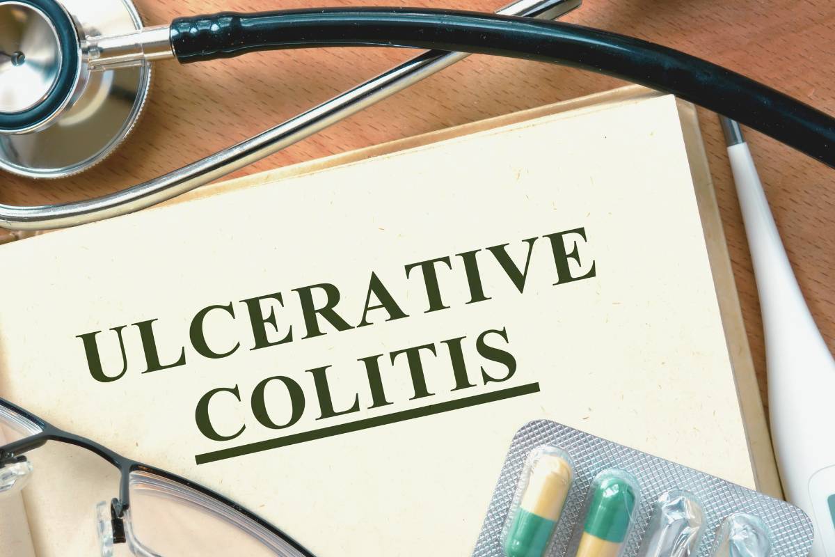 Ulcerative Colitis Diagnosis