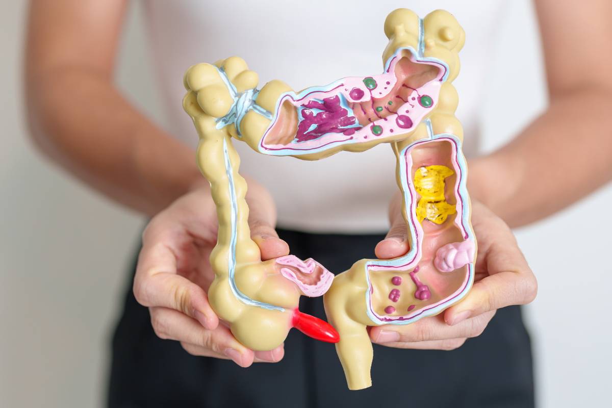 how to diagnose ulcerative colitis
