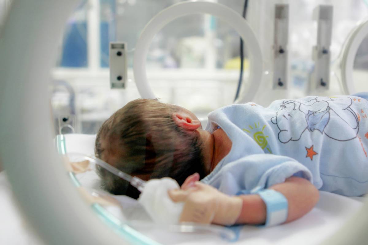 Hirschsprung’s Disease