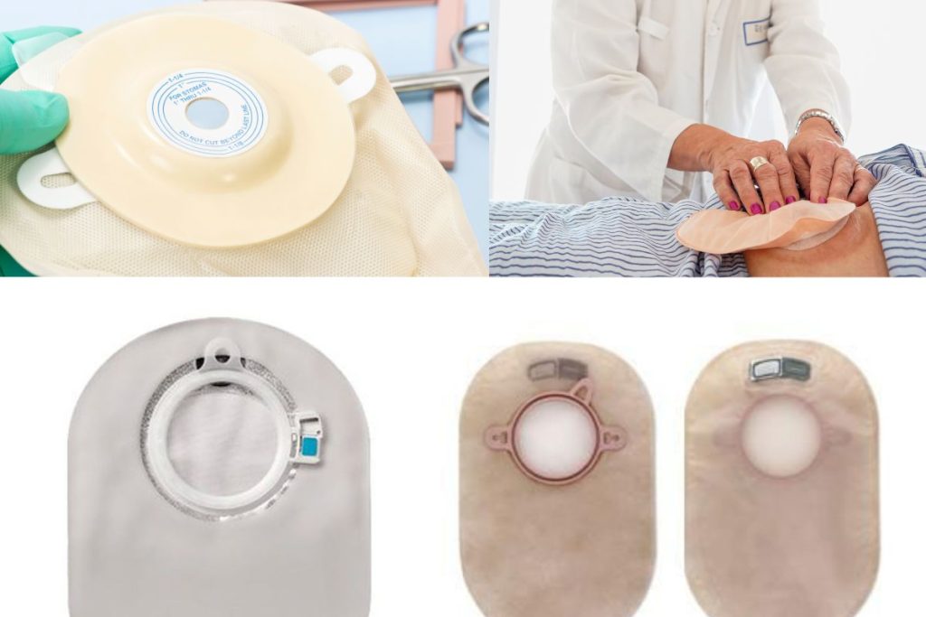 do you need an ostomy bag filter